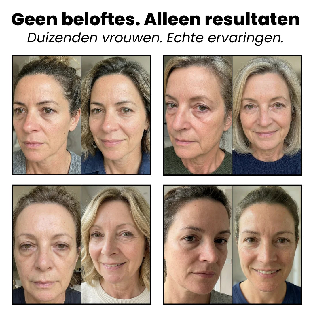 Hydrogel Under Eye Patch – Frissere Ogen in 15 Minuten